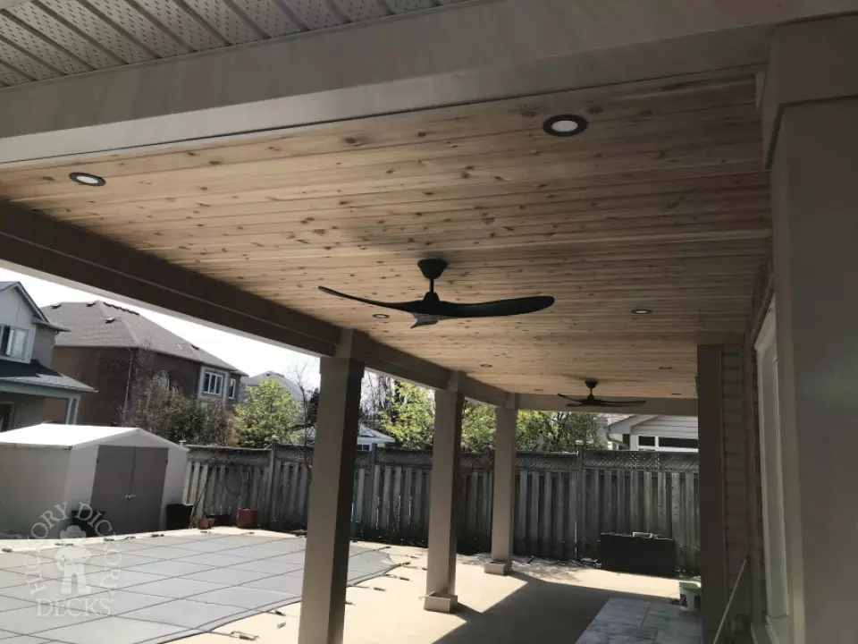custom roof with lights and ceiling